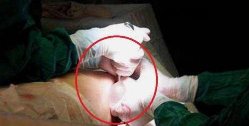 取环视频播放,跟随视频学习取环技巧